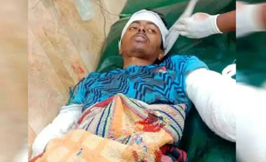 স্ত্রীর গোপন ভিডিও করায় সইতে না পেরে ছোট ভাইয়ের যে অঙ্গ কেটে দিলো ভাই