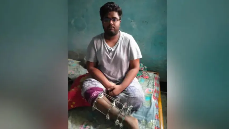 টিউশনির পাশাপাশি পাঠাওয়ে কাজ করা জুলাইযোদ্ধা কাতরাচ্ছেন বিছানায়