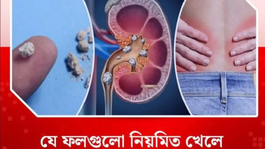 যে ফলগুলো নিয়মিত খেলে কিডনিতে পাথর হওয়ার ঝুঁকি কমে